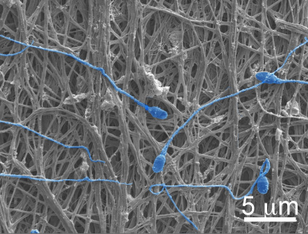 Sperm caught in a nanofiber mesh.