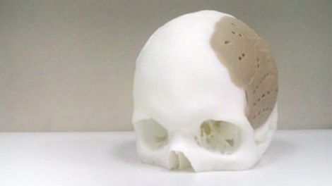 Thanks for my new 3D printed skull
