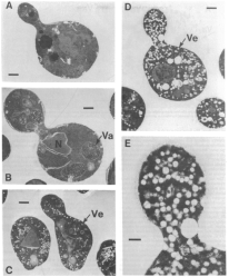 Retro Science: A figure from Schekman's breakthrough 1979 paper, showing how vessicles—the sacs used to transport proteins in and out of cells—accumulate in mutant yeast cells. A and B show normal cells, while C, D, and E show mutations that markedly increase the number of vessicles (Ve) in the cell. 
