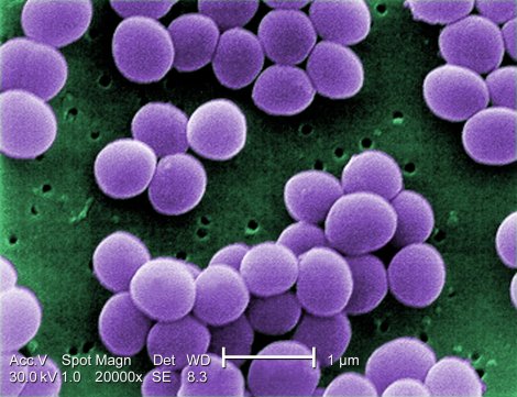 A drug resistant strain of Staphylococcus aureus bacteria (staph).