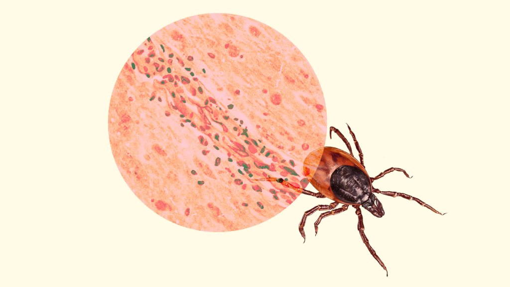 Illustration: a large pink and orange circle with small red and green blobs representing a microscopic view of Powassan virus; a deer tick positioned in the bottom right section of the circle as though walking out of frame