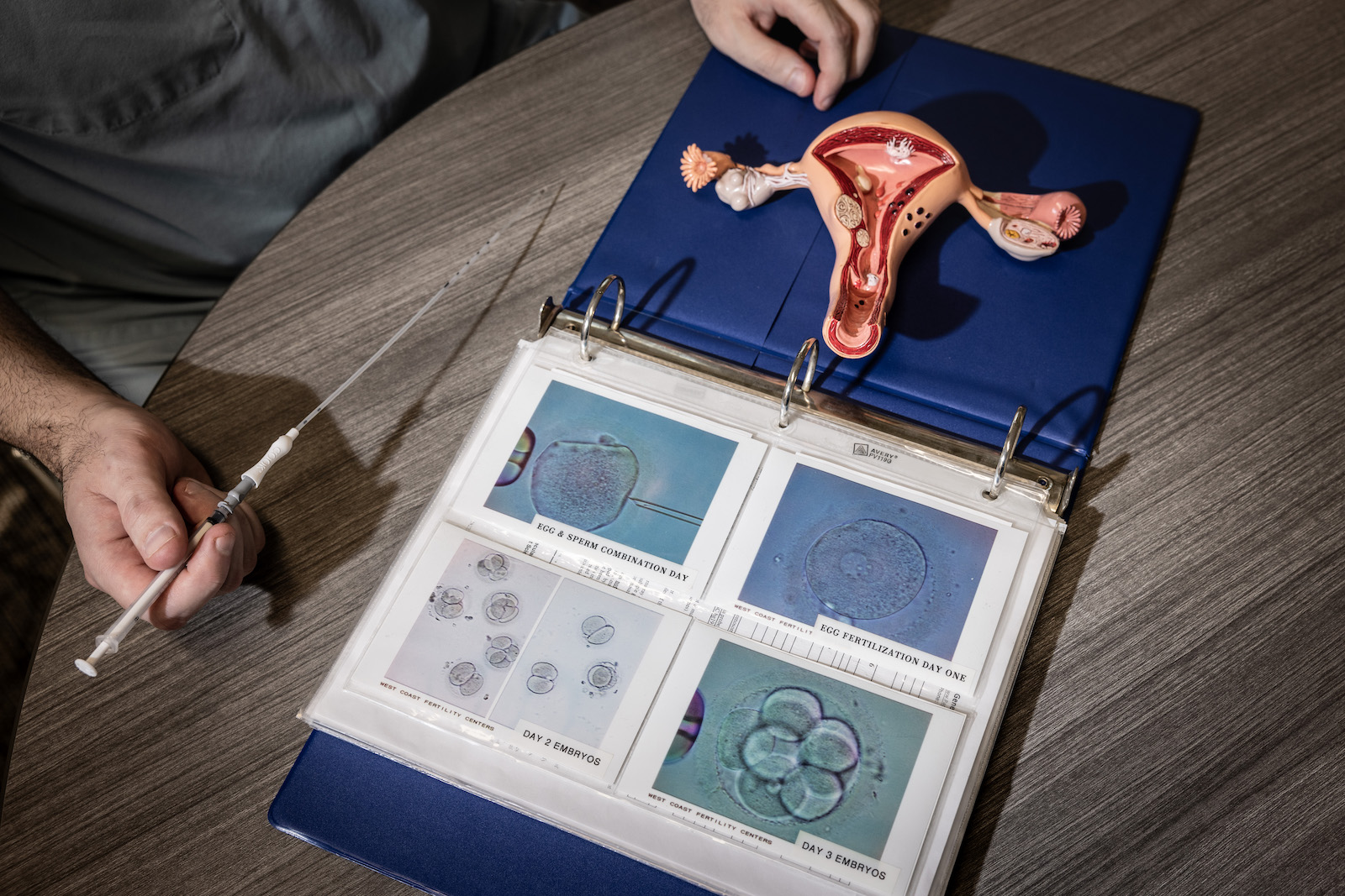 a binder full of photos of embryos and a plastic uterus model
