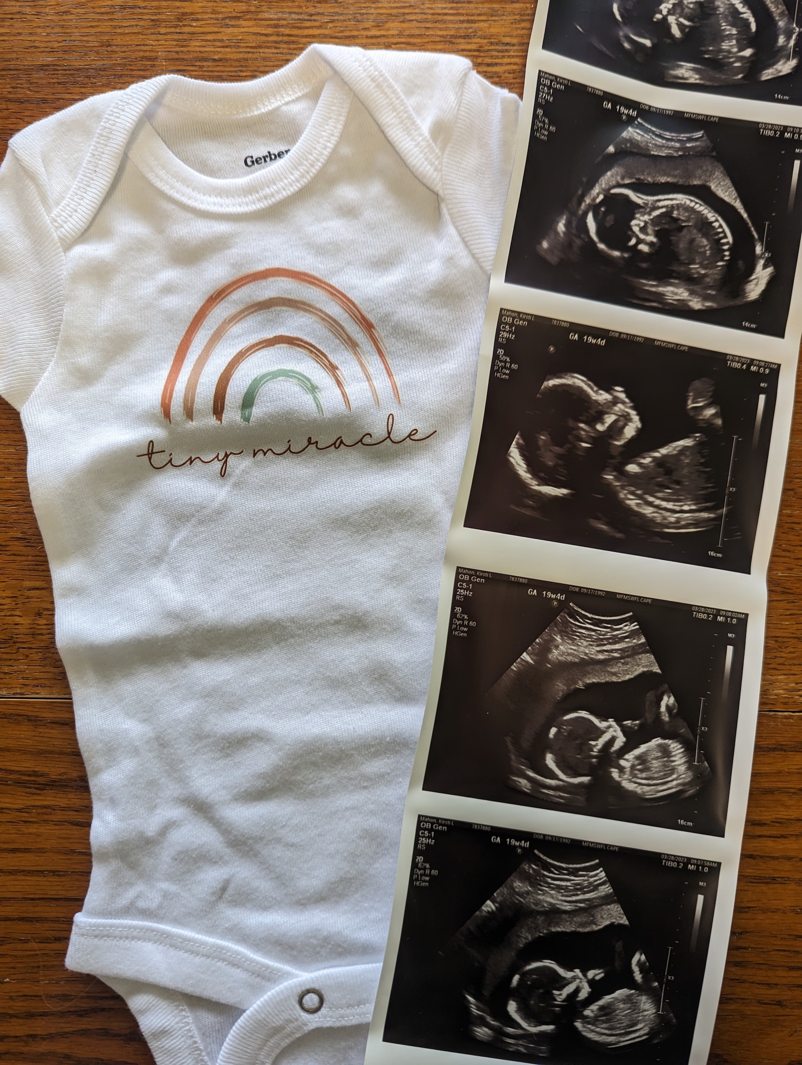 a onesie with a rainbow and a series of ultrasound photos of a fetus