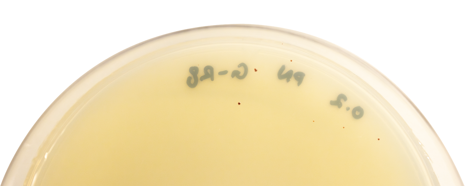 A petri dish with writing and a few really small red dots on it