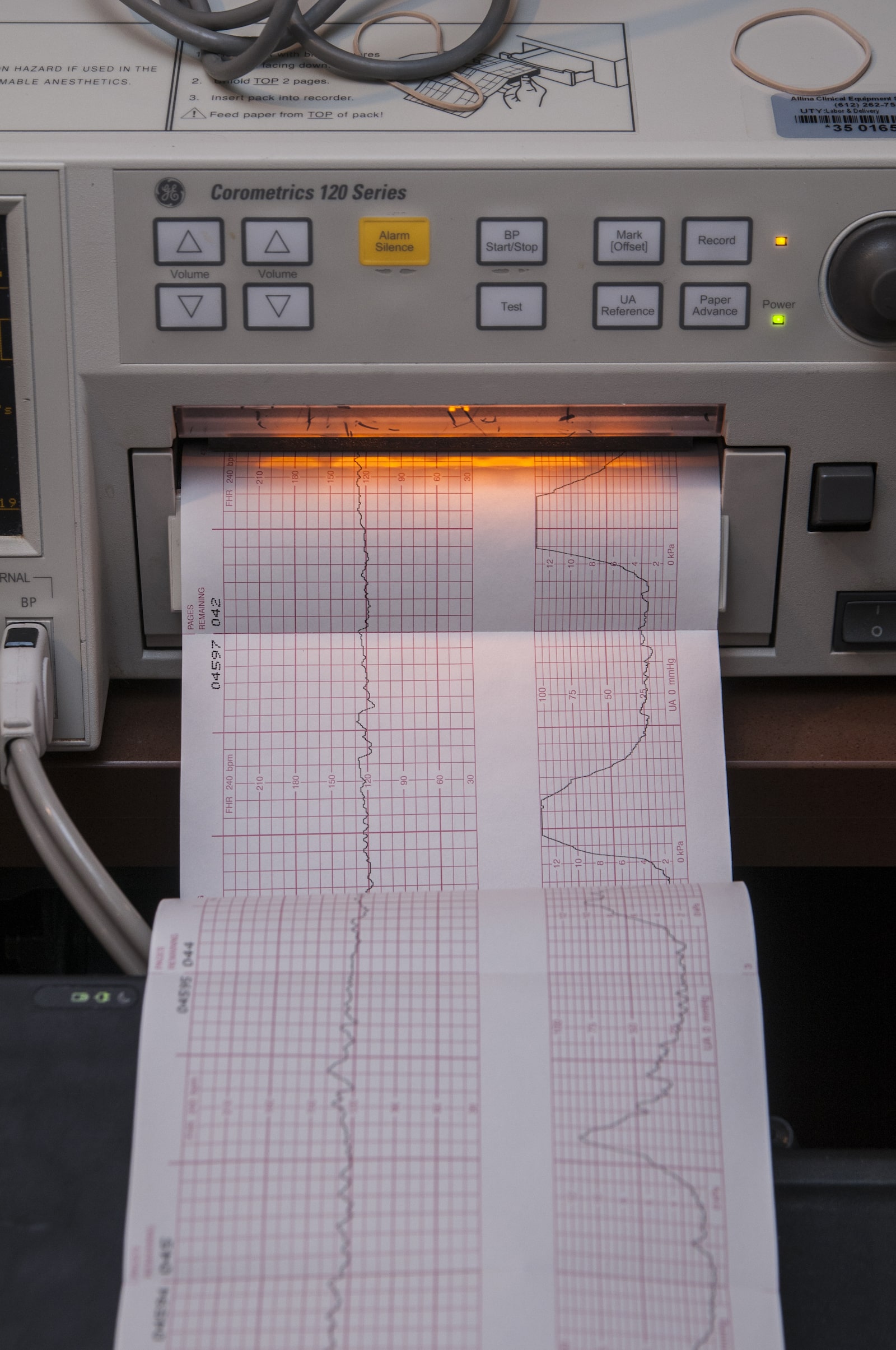 A machine with a long printout showing lines and graphs