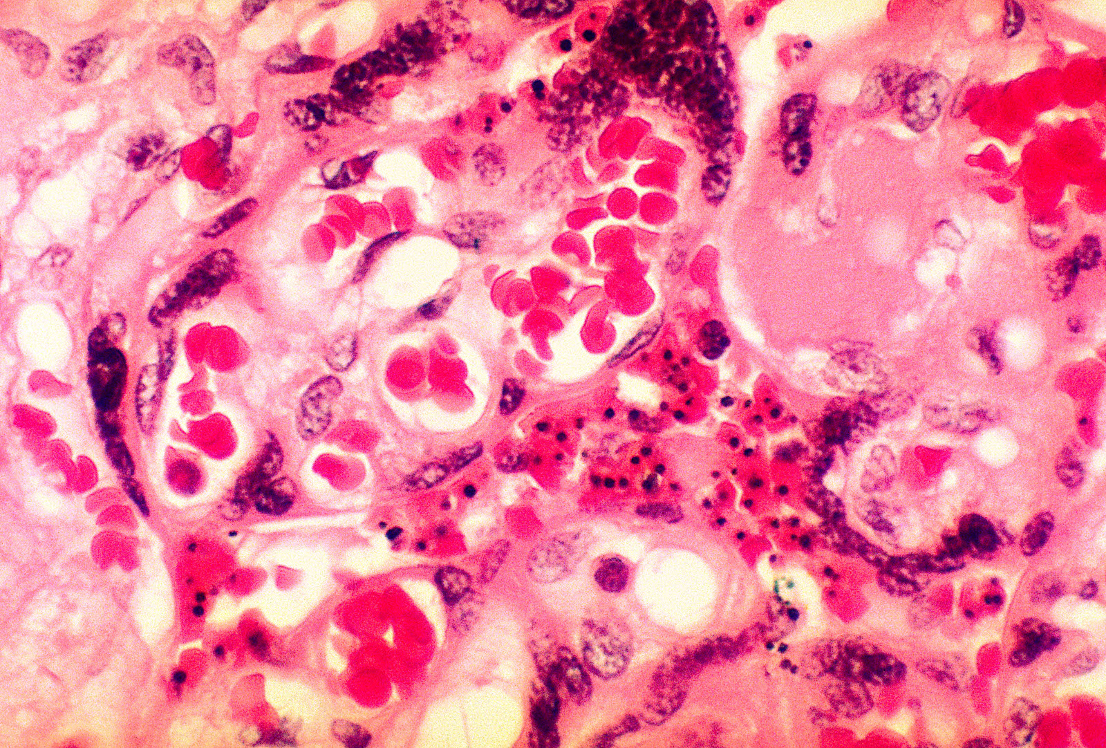 A histological slide of pink tissues and cells
