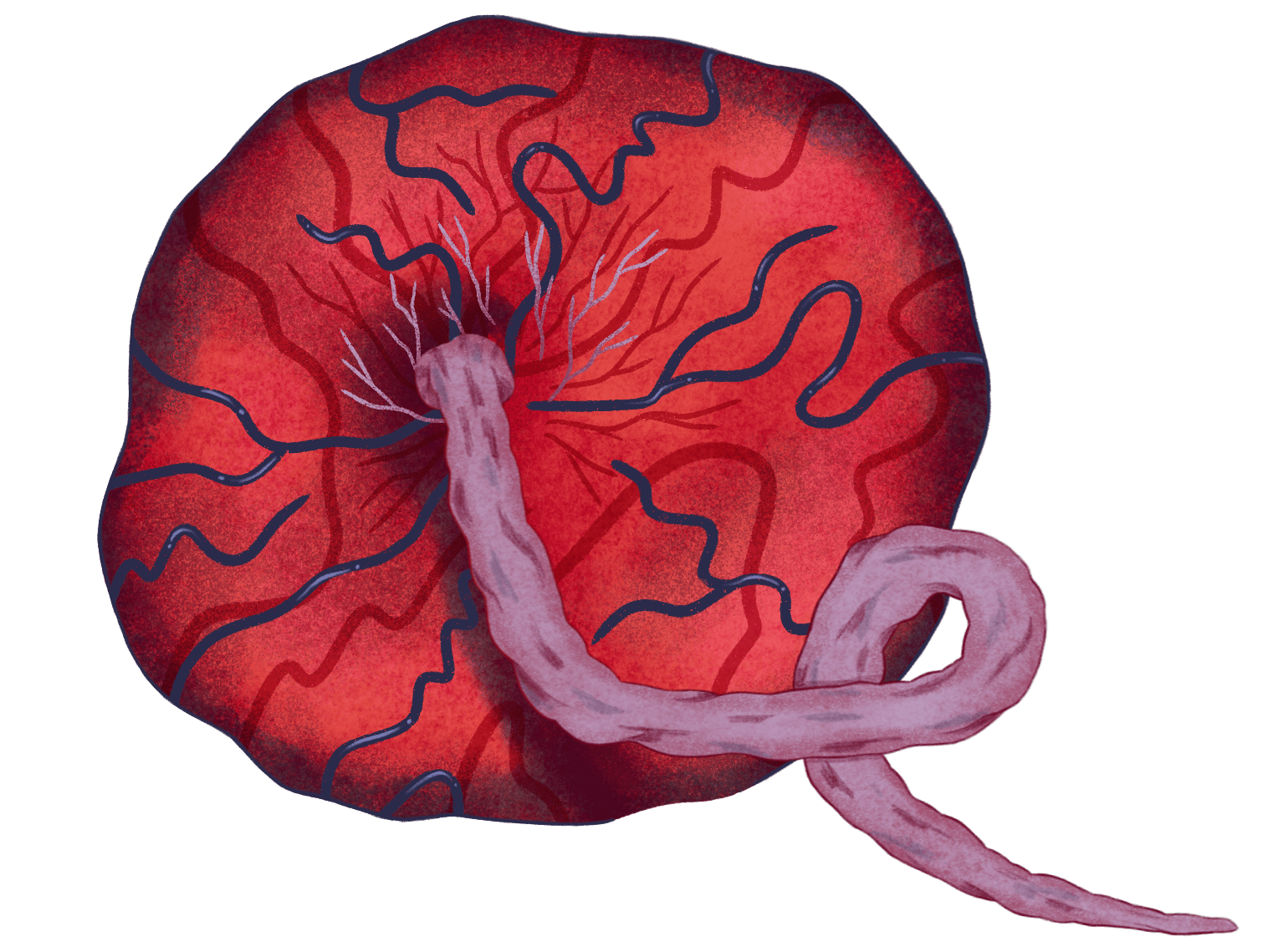 An illustration of a placenta