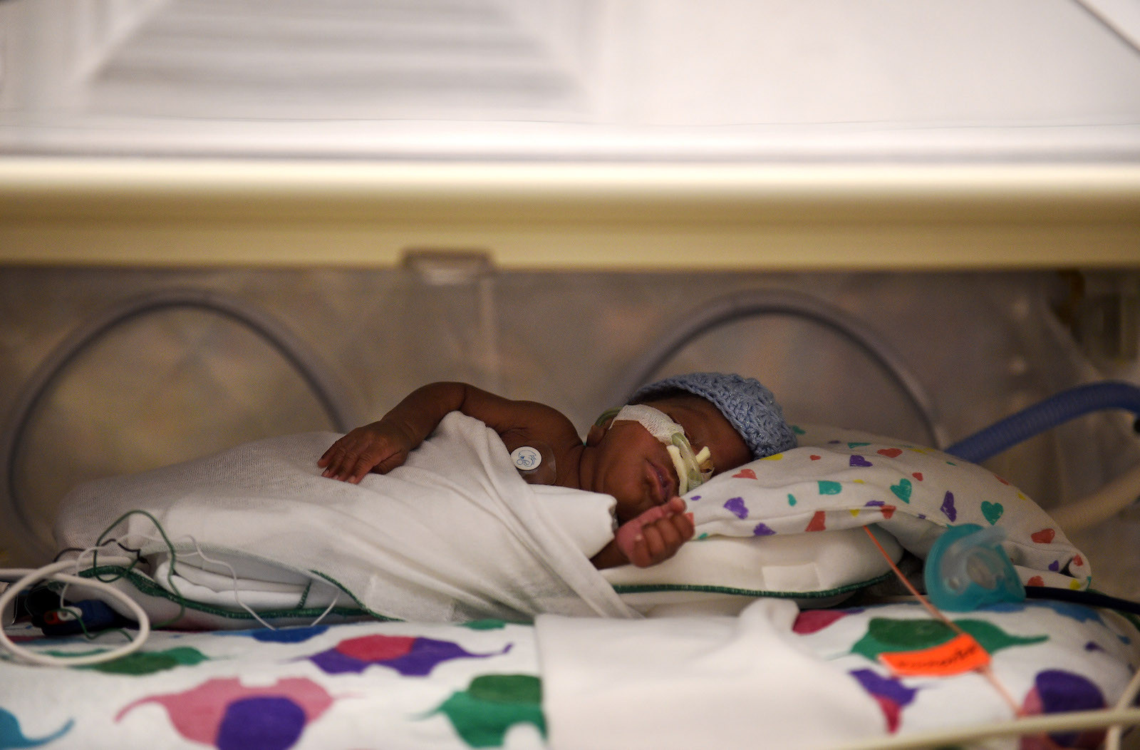 A baby with a feeding tube and a head covering in a preterm birth ward